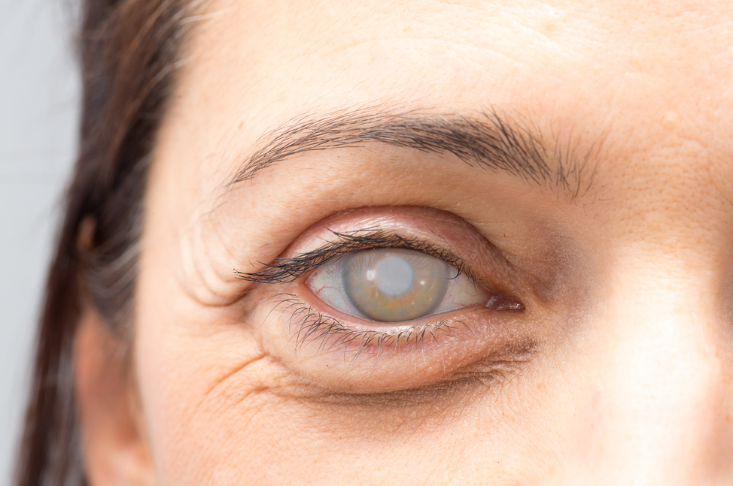 bien-chung-tieu-duong-tuyp-2-4