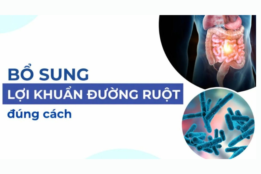thuoc-bo-sung-loi-khuan-duong-ruot-3