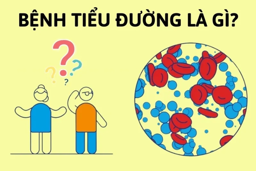 trieu-chung-dai-thao-duong-1