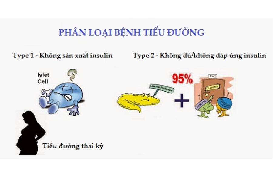 trieu-chung-dai-thao-duong-3