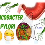 vi-khuan-hp-da-day-co-lay-khong-1