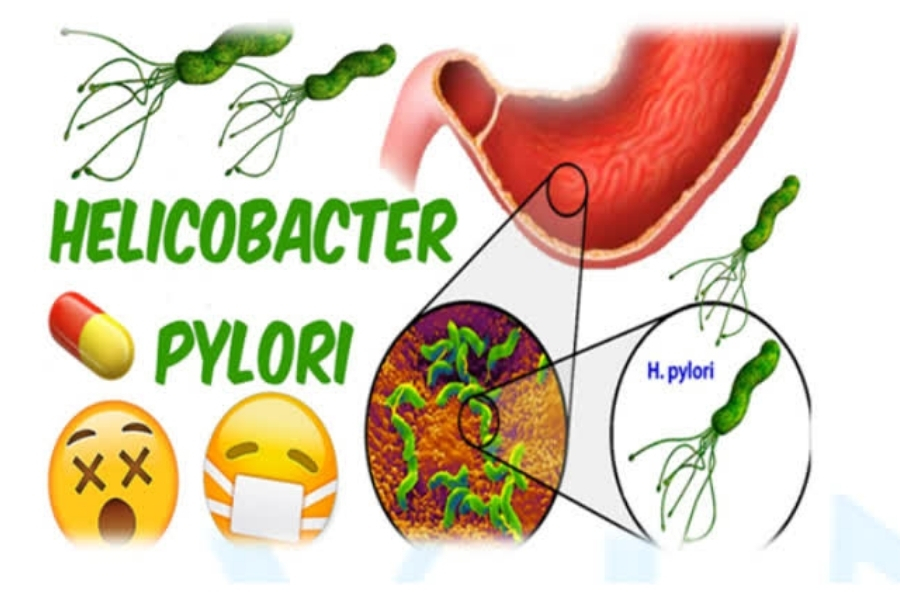 vi-khuan-hp-da-day-co-lay-khong-1