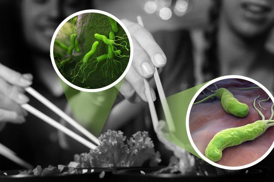 vi-khuan-hp-da-day-co-lay-khong-2