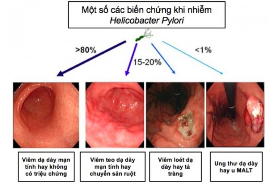 viem-da-day-hp-duong-tinh-4