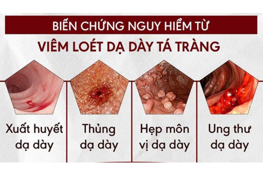 viem-loet-da-day-ta-trang-5