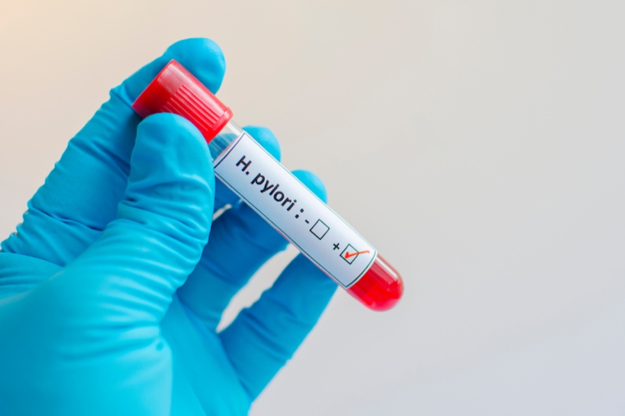 xet-nghiem-hp-da-day-4