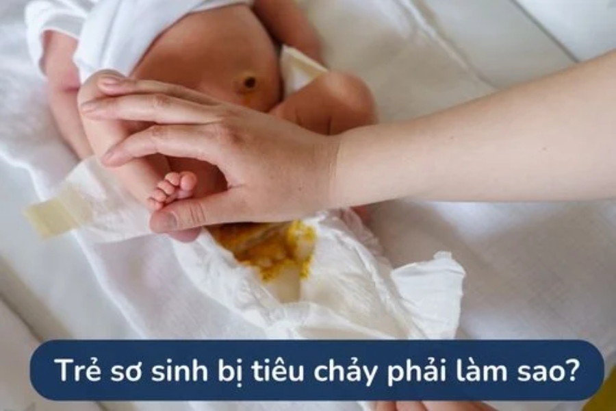 tre-so-sinh-bi-tieu-chay-bao-lau-thi-khoi-1