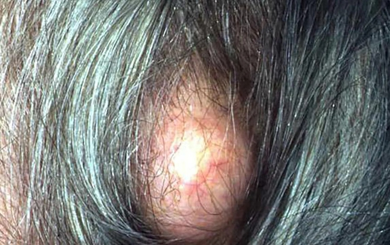 image-2
