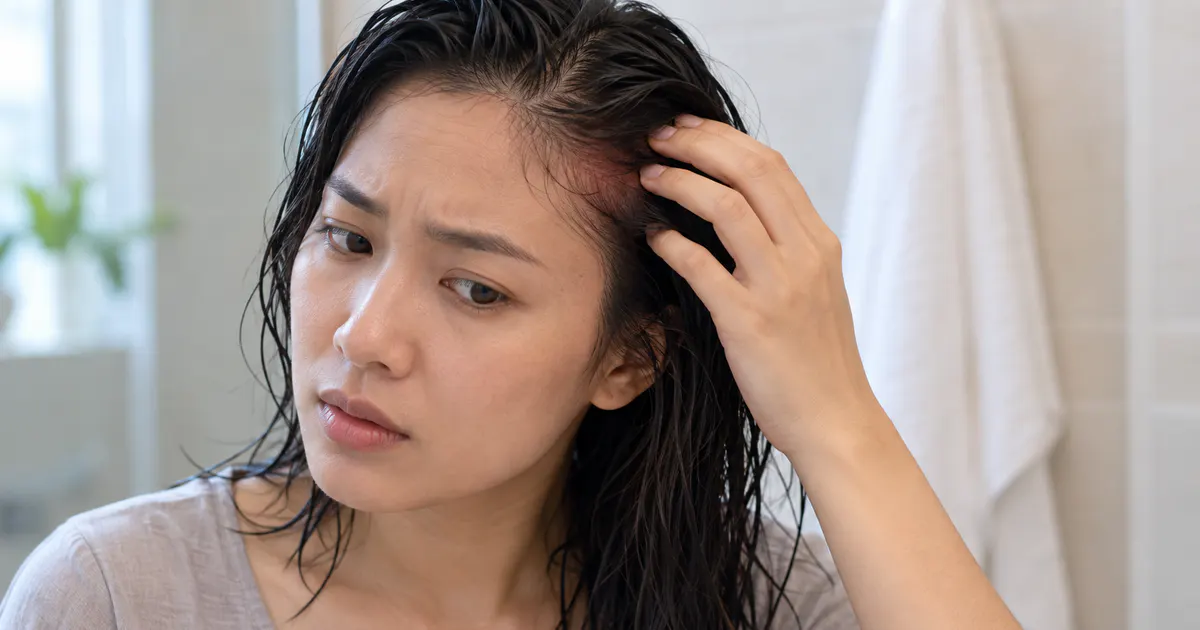 Theo dõi cảm giác ngứa hoặc đỏ da đầu sau khi gội