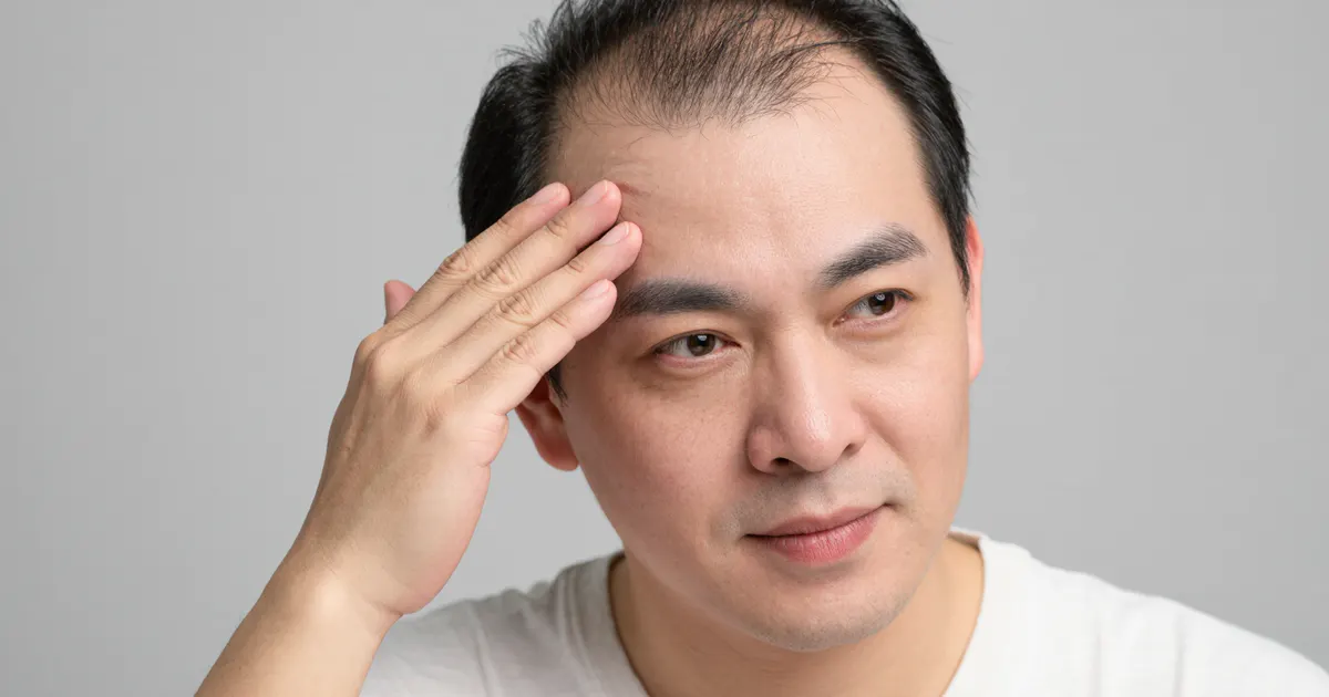 Cận cảnh người trưởng thành chăm sóc da đầu bị viêm da tiết bã với động tác gội nhẹ nhàng