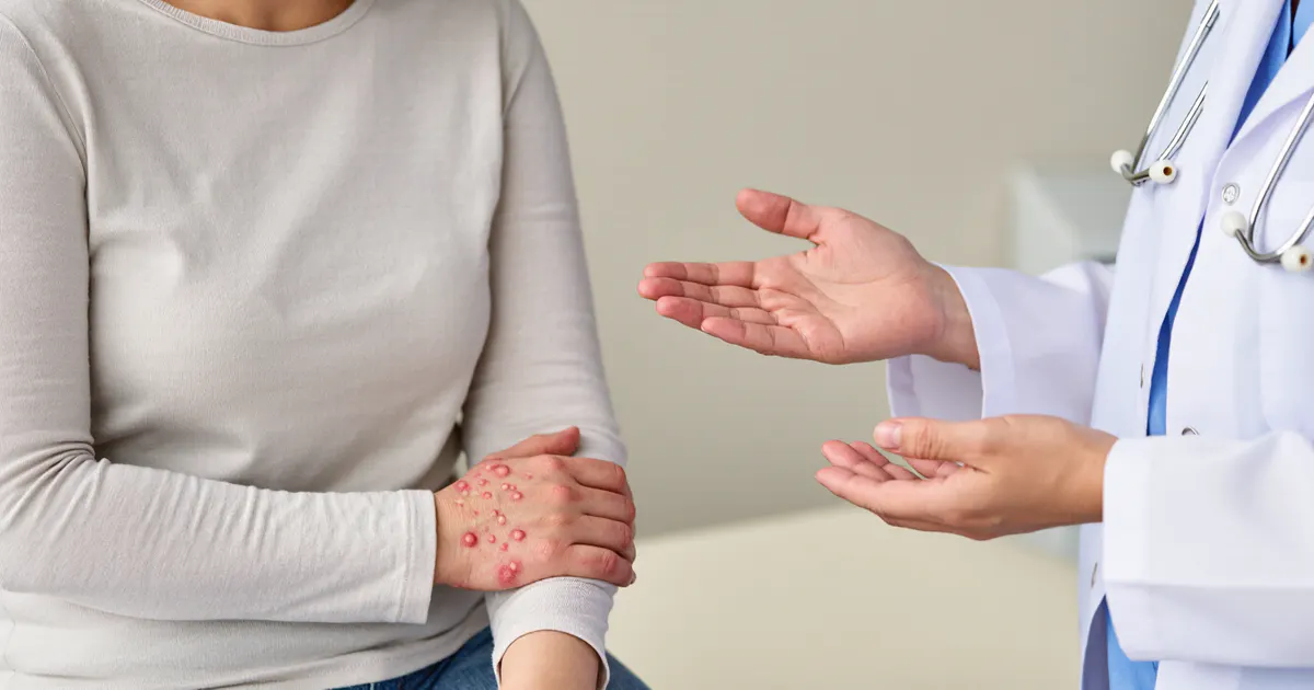 Người có da dị ứng trao đổi với nhân viên y tế khi triệu chứng nặng hơn