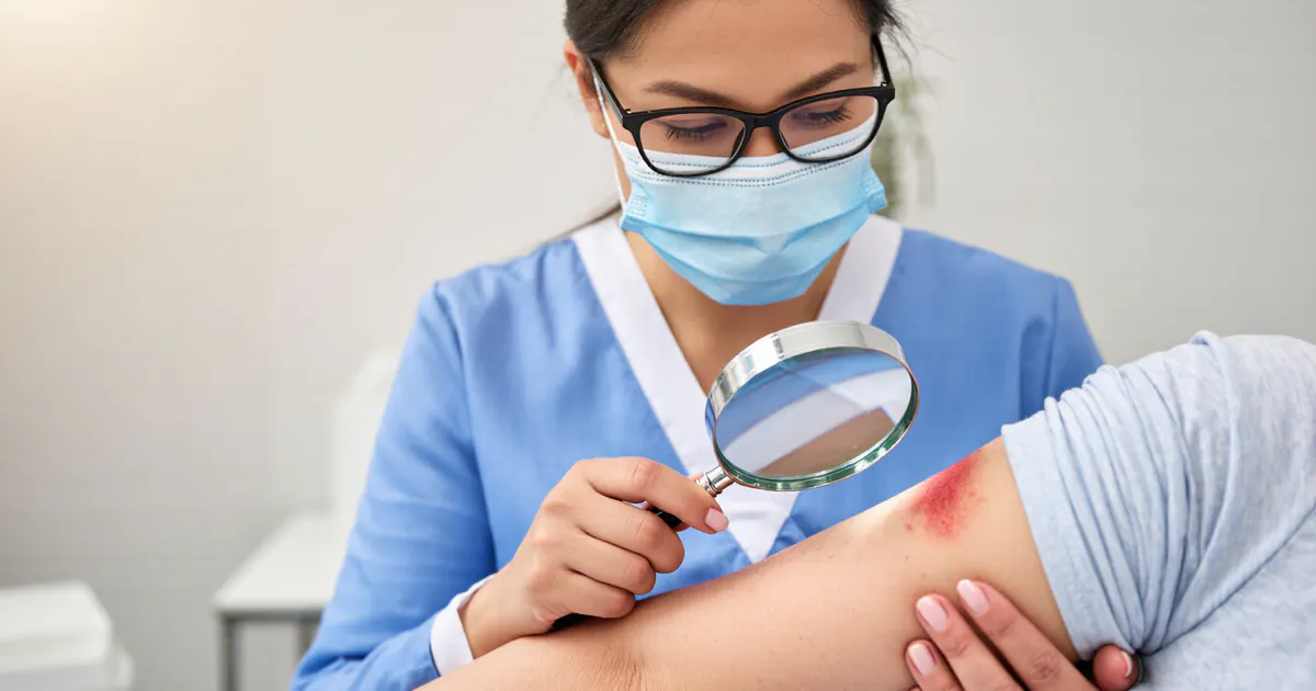 Cận cảnh chăm sóc vùng da có dấu hiệu viêm nang lông và tìm hiểu thuốc đặc trị viêm nang lông