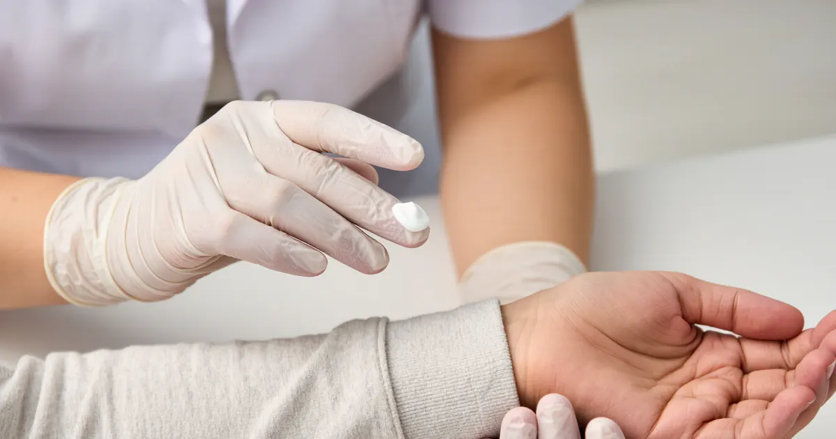 Tư vấn sử dụng thuốc bôi chống viêm da an toàn