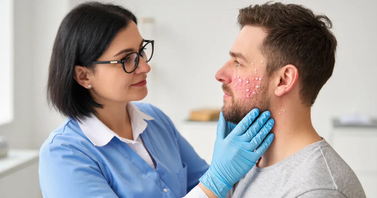 Bác sĩ tư vấn thuốc trị viêm da tiết bã nhờn ở mặt cho người bệnh