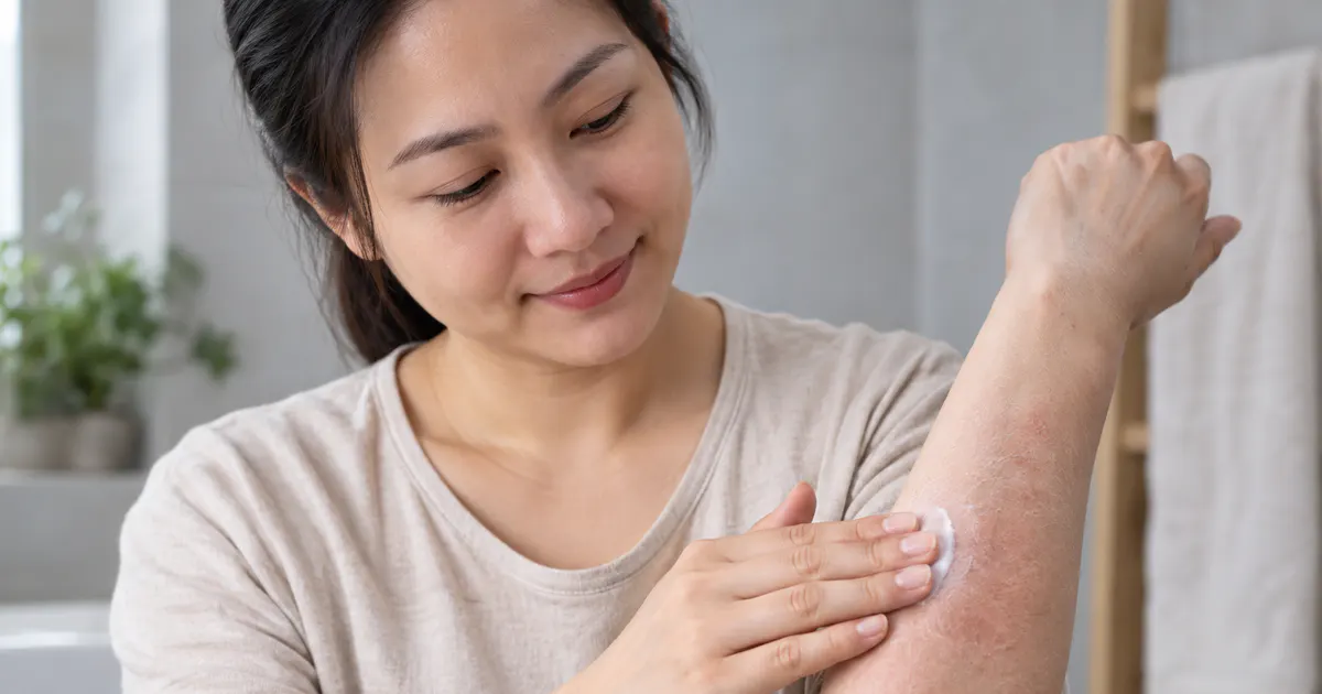 Người trưởng thành chăm sóc vùng da khô ngứa do viêm da cơ địa có hết không