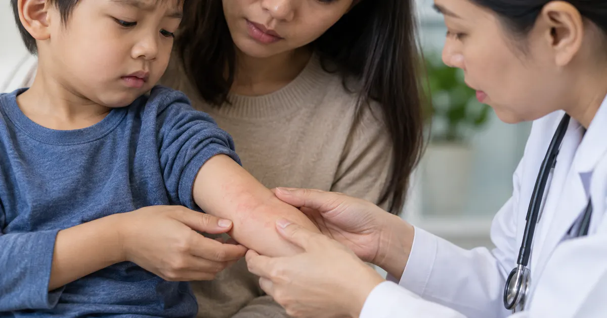 Phụ huynh quan sát vùng da đỏ của trẻ để nhận biết dấu hiệu cần khám