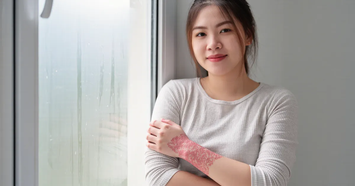Người mặc quần áo thoáng nhẹ nhàng bảo vệ vùng da dễ kích ứng trước yếu tố môi trường