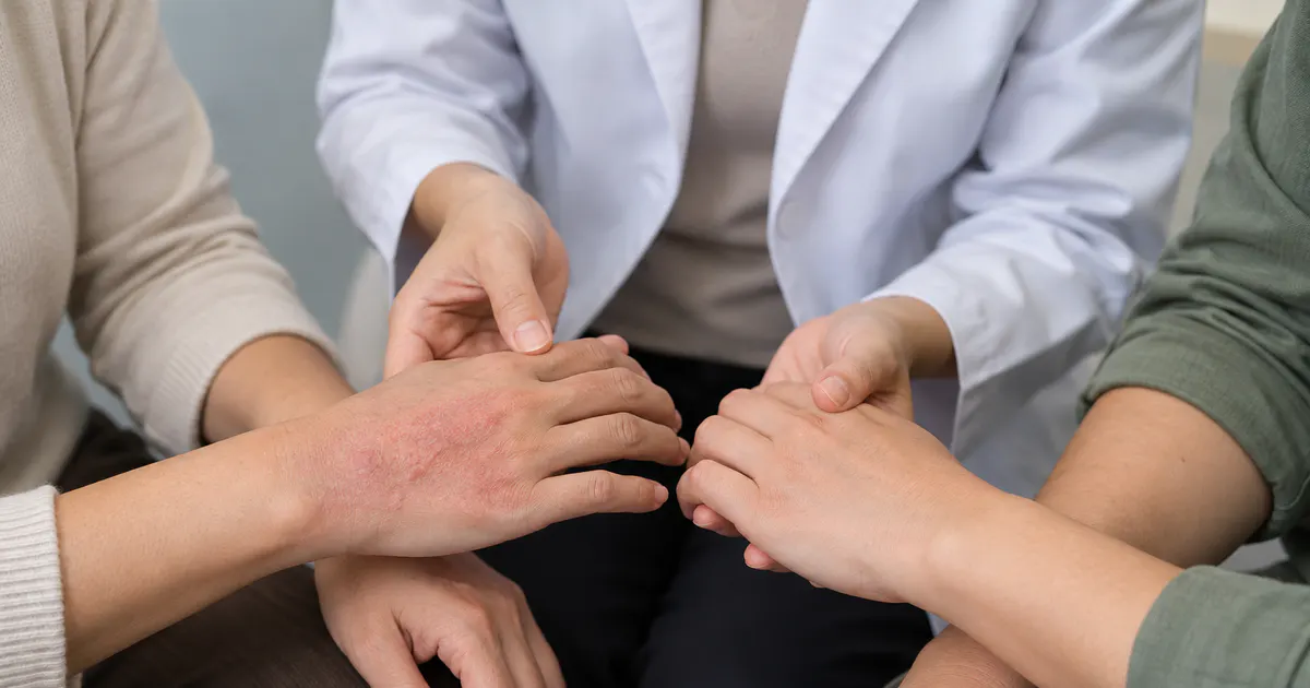 Bác sĩ quan sát vùng da tổn thương để phân biệt viêm da tiếp xúc với bệnh da có thể lây