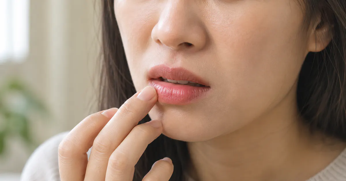 Cận cảnh người chăm sóc đôi môi khô đỏ do viêm môi dị ứng