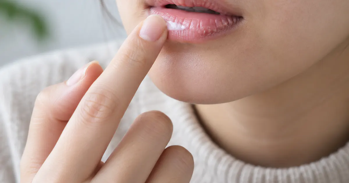 Chăm sóc môi nhẹ nhàng tại nhà khi bị viêm môi dị ứng