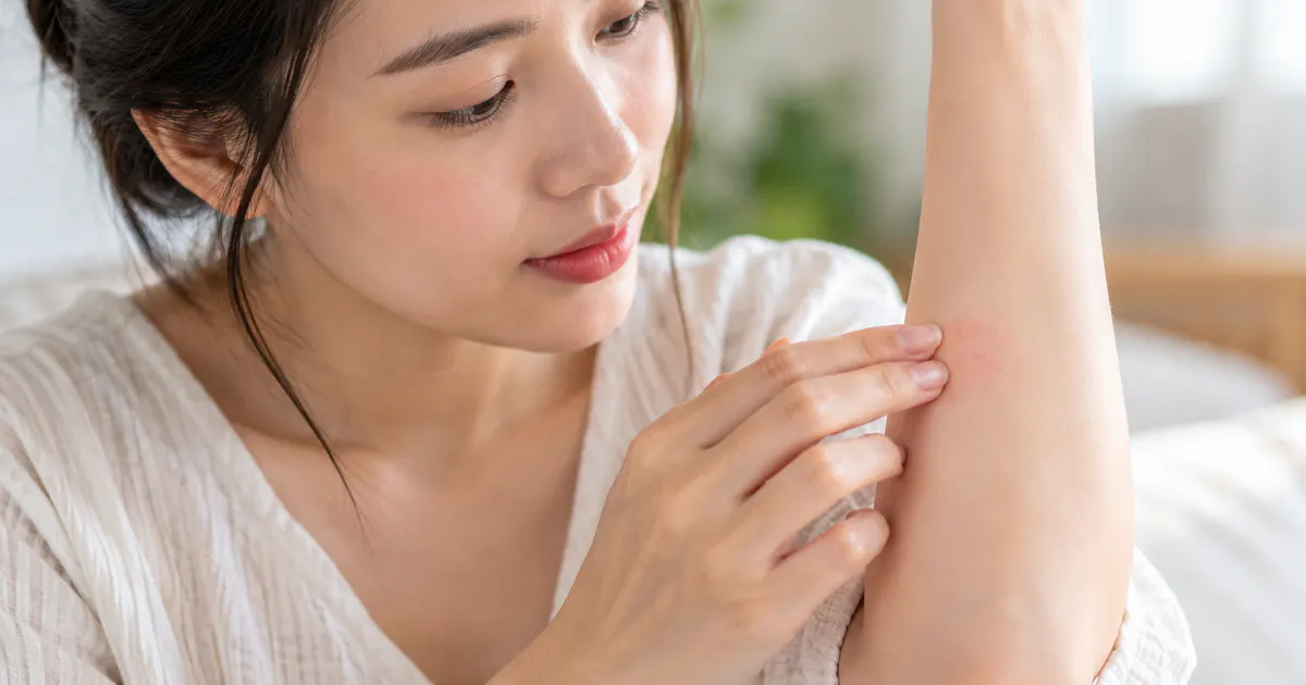 Thử sản phẩm chăm sóc da trên vùng nhỏ trước khi dùng niacinamide và retinol
