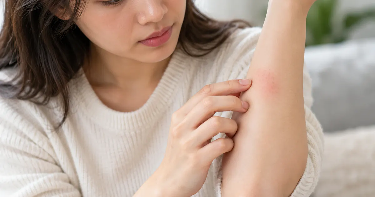 Theo dõi vùng da nhỏ sau khi thử sản phẩm chăm sóc da mới
