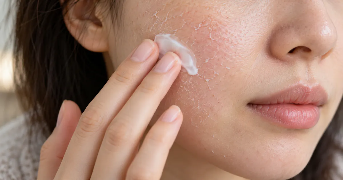 Thoa dưỡng ẩm nhẹ nhàng để hỗ trợ hàng rào bảo vệ da mùa hanh khô