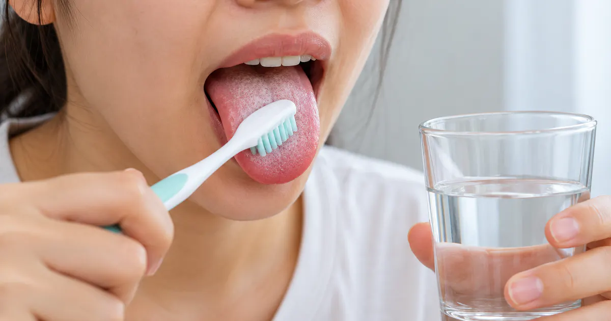 Chăm sóc lưỡi nhẹ nhàng khi có khô miệng và vị khó chịu
