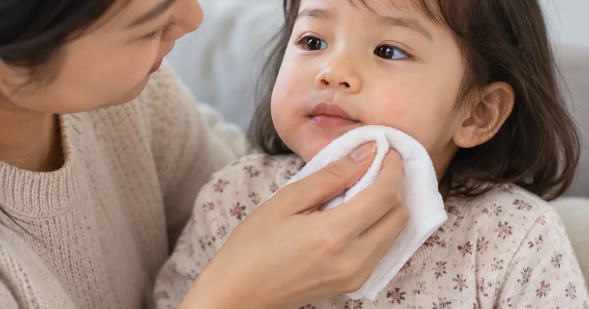 Chăm sóc nhẹ nhàng vùng da quanh miệng cho trẻ tại nhà